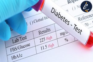 آزمایش های تشخیصی دیابت