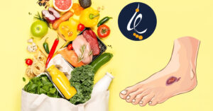 رژیم غذایی مفید برای بهبود زخم دیابتی