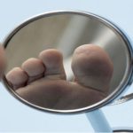 چگونه از زخم پای دیابتی پیشگیری کنیم؟