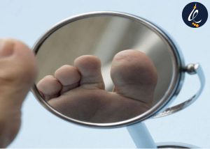 چگونه از زخم پای دیابتی پیشگیری کنیم؟