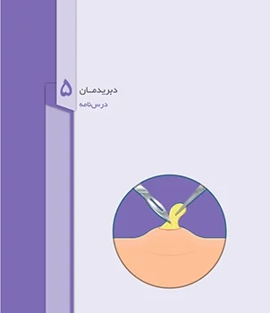 پانسمان دبری سافت