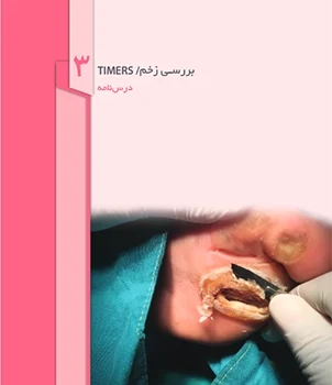 همسان سازی لبه ها برای اپیتله سازی