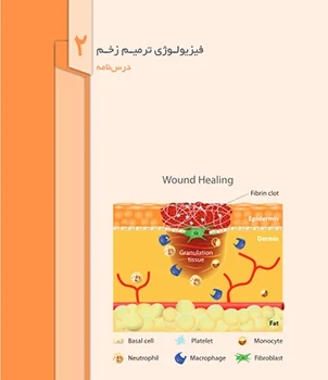 ایجاد آبسه عفونی در پشت بافت نکروز