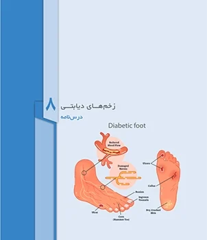 فصل 8 زخم های دیابتی