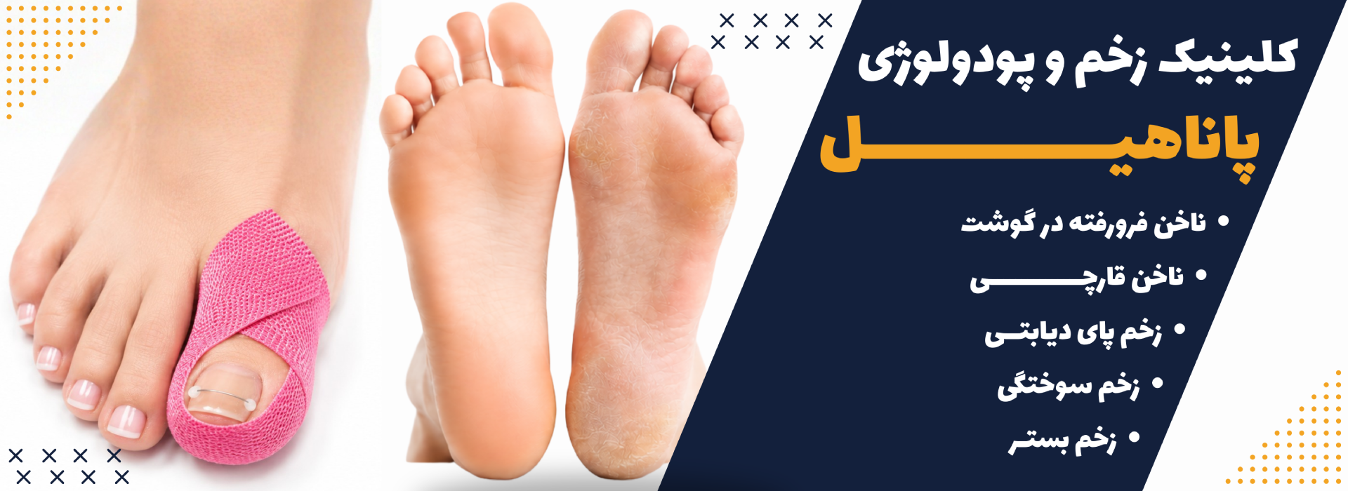 درمان و مراقبت از زخم، دیابت، پا و ناخن پاناهیل کرج