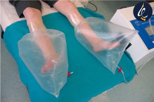 فواید اوزون تراپی