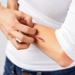 چرا زخم ها خارش دارند؟