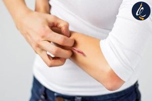 چرا زخم ها خارش دارند؟