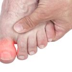 انواع مشکلات ناخن شست پا