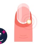 درد ناخن چیست؟