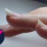 ناخن ترامپلین و سربالا