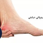 علائم پای دیابتی