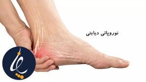 علائم پای دیابتی