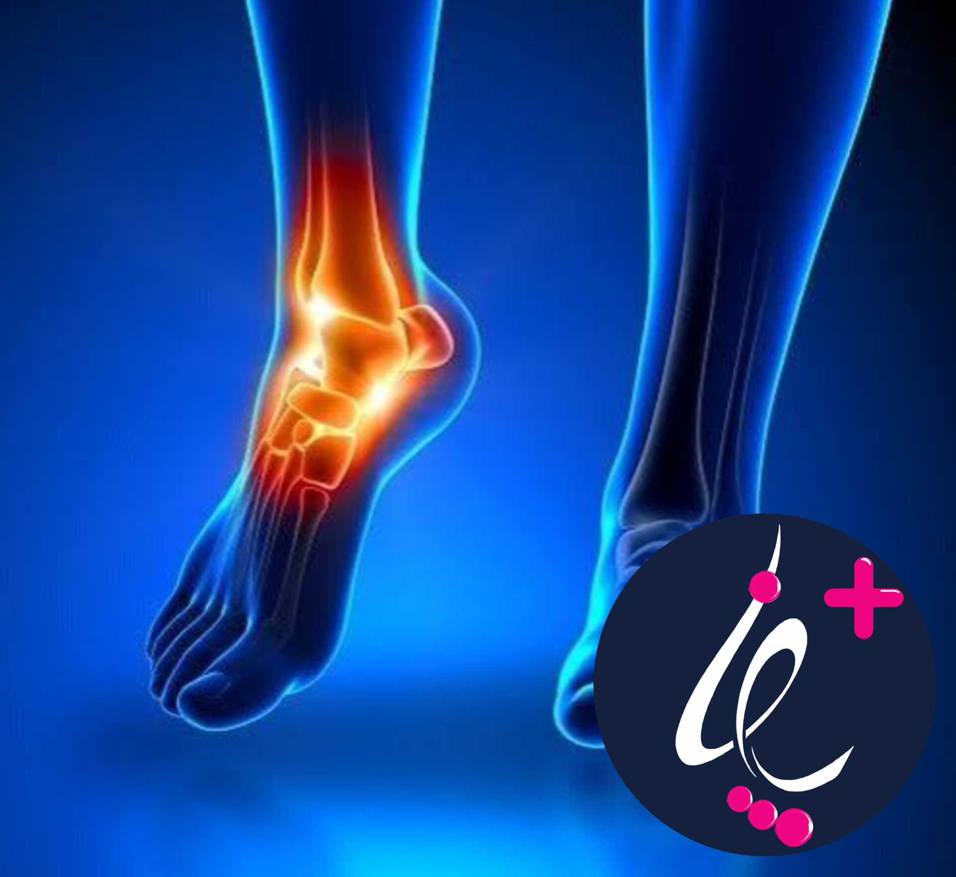 چرا مچ پا موقع ورزش درد می‌گیرد؟