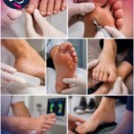 خدمات پودولوژی برای بیماران دیابتی