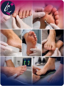 خدمات پودولوژی برای بیماران دیابتی