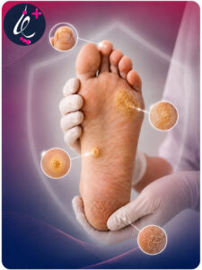 خدمات کلینیک پودولوژی پاناهیل کرج